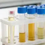 THCA detection times in urine, blood, and hair tests.